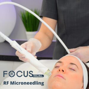 Radiofrequency Microneedling