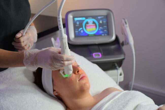 RF Microneedling blog image